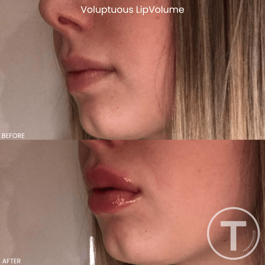 Facefixers Voluptuous Lipvolume