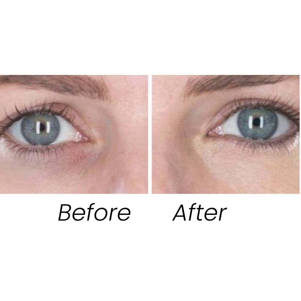 FlawLess EyeRetouch Serum - Transformulas